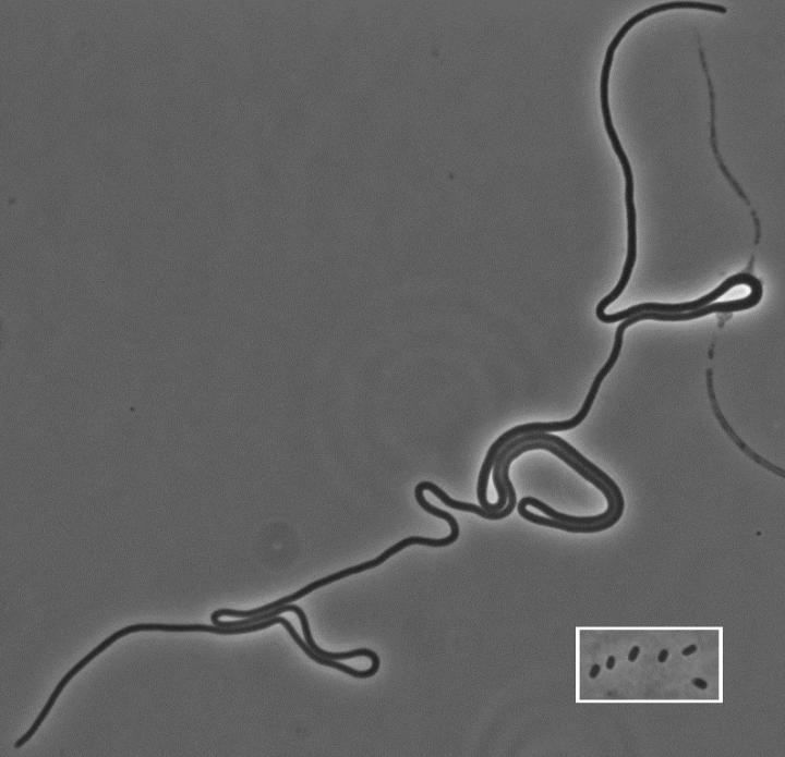  a 3/4 of a mm long mutant escherichia coli 